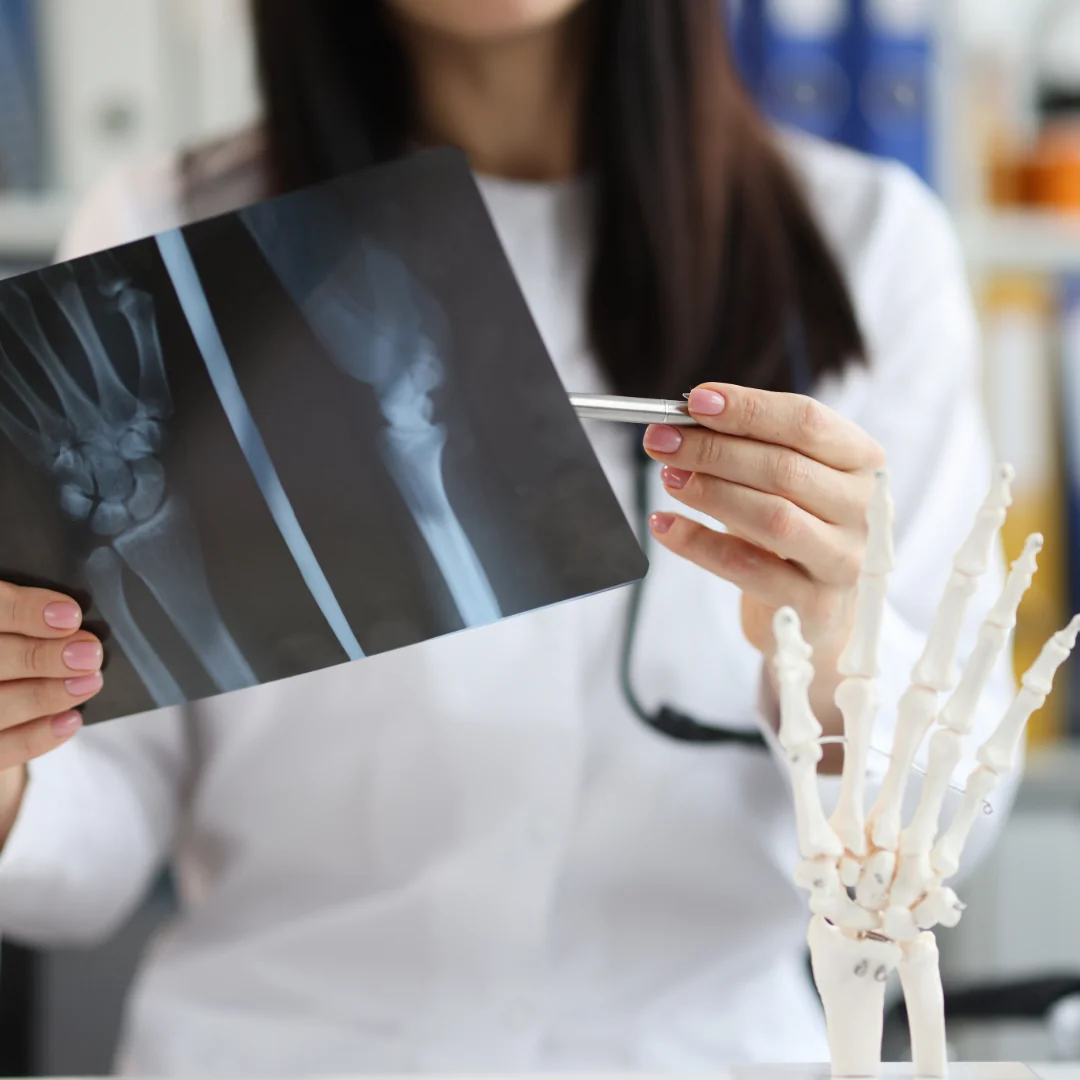 SEO para Traumatólogos: Atrae Pacientes con Lesiones y Fracturas 2025