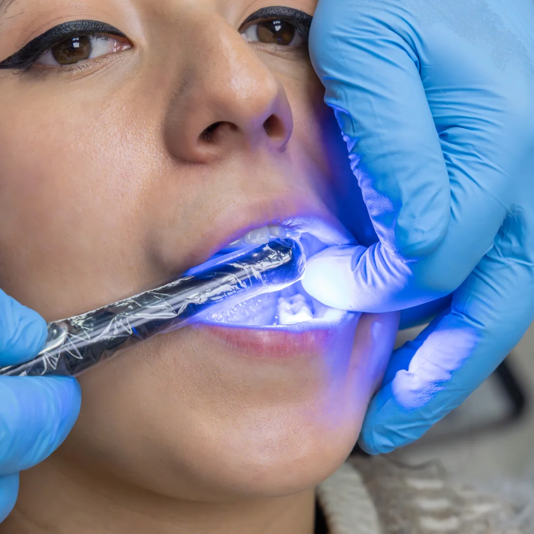 Keywords para Dentistas: Posiciona tu Clínica 2025